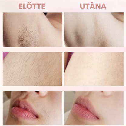 Bloomify™ - 2 az 1-ben szőrtelenítő készülék